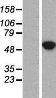 Western Blot: Argininosuccinate Lyase Overexpression Lysate [NBP2-11175]