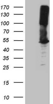 Western Blot: Argininosuccinate Synthase Antibody (OTI1B10) [NBP2-46551]