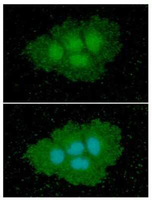 Immunocytochemistry/ Immunofluorescence: Argininosuccinate Synthase Antibody (1G11) - BSA Free [NBP2-59443]