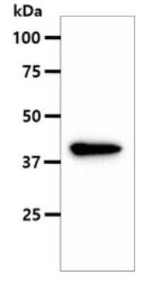 Western Blot: Argininosuccinate Synthase Antibody (1G11)BSA Free [NBP2-59443]