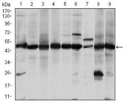 Western Blot: Argininosuccinate Synthase Antibody (2B10)BSA Free [NBP2-37520]