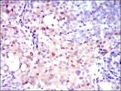Immunohistochemistry: Argininosuccinate Synthase Antibody (2C10) - BSA Free [NBP2-37518]