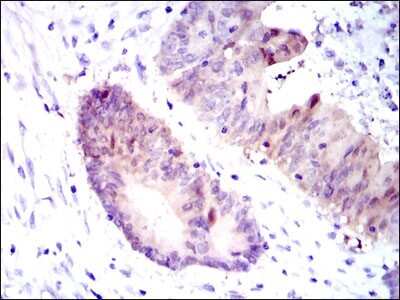 Immunohistochemistry: Argininosuccinate Synthase Antibody (2C10) - BSA Free [NBP2-37518]