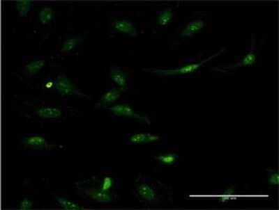 Immunocytochemistry/ Immunofluorescence: Argininosuccinate Synthase Antibody (2D2) [H00000445-M02]