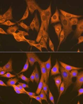 Immunocytochemistry/ Immunofluorescence: Argininosuccinate Synthase Antibody (4W1M8) [NBP3-16749]