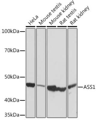 Western Blot: Argininosuccinate Synthase Antibody (4W1M8) [NBP3-16749]