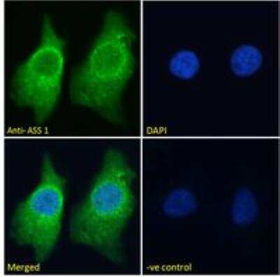 Immunocytochemistry/ Immunofluorescence: Argininosuccinate Synthase Antibody [NBP1-00153]