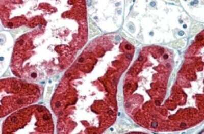 Immunohistochemistry-Paraffin: Argininosuccinate Synthase Antibody [NBP1-00153]