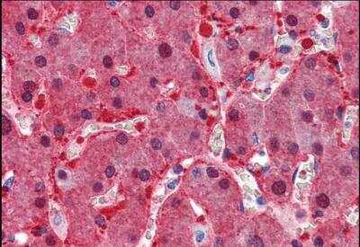Immunohistochemistry-Paraffin: Argininosuccinate Synthase Antibody [NBP1-00153]