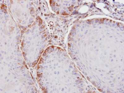 Immunohistochemistry-Paraffin: Argininosuccinate Synthase Antibody [NBP1-31522]