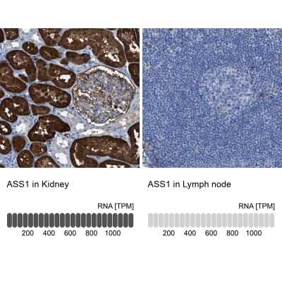 Immunohistochemistry-Paraffin: Argininosuccinate Synthase Antibody [NBP1-88867]