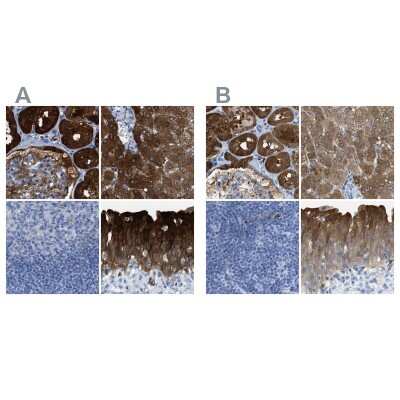 Immunohistochemistry-Paraffin: Argininosuccinate Synthase Antibody [NBP1-88867]