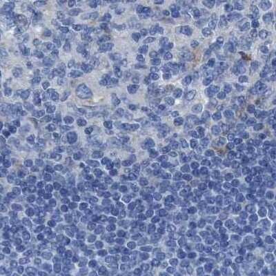 Immunohistochemistry-Paraffin: Argininosuccinate Synthase Antibody [NBP1-88867]