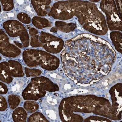 Immunohistochemistry-Paraffin: Argininosuccinate Synthase Antibody [NBP1-88867]