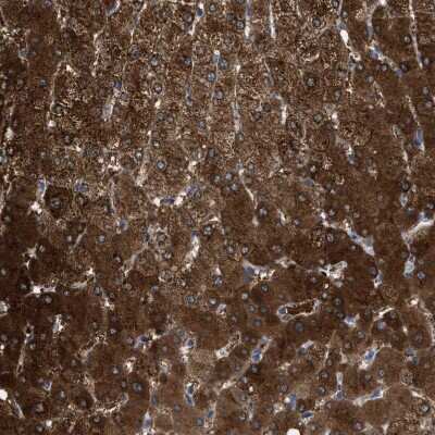 Immunohistochemistry-Paraffin: Argininosuccinate Synthase Antibody [NBP1-88867]