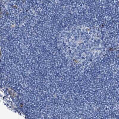 Immunohistochemistry-Paraffin: Argininosuccinate Synthase Antibody [NBP1-88867]