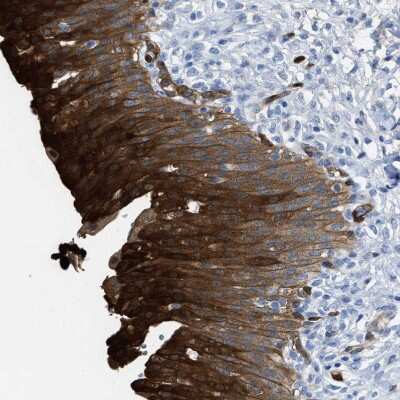 Immunohistochemistry-Paraffin: Argininosuccinate Synthase Antibody [NBP1-88867]