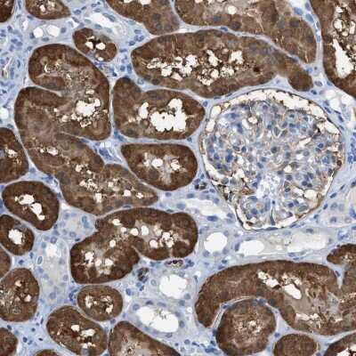 Immunohistochemistry-Paraffin: Argininosuccinate Synthase Antibody [NBP1-88868]