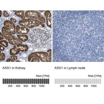Immunohistochemistry-Paraffin: Argininosuccinate Synthase Antibody [NBP1-88868]