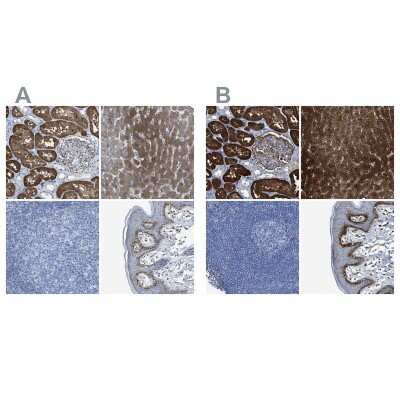 Immunohistochemistry-Paraffin: Argininosuccinate Synthase Antibody [NBP1-88868]