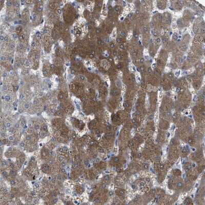Immunohistochemistry-Paraffin: Argininosuccinate Synthase Antibody [NBP1-88868]