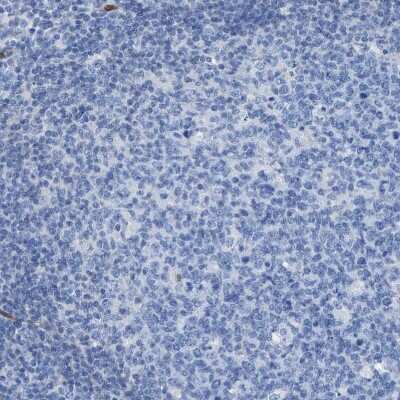 Immunohistochemistry-Paraffin: Argininosuccinate Synthase Antibody [NBP1-88868]