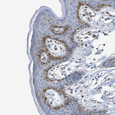 Immunohistochemistry-Paraffin: Argininosuccinate Synthase Antibody [NBP1-88868]