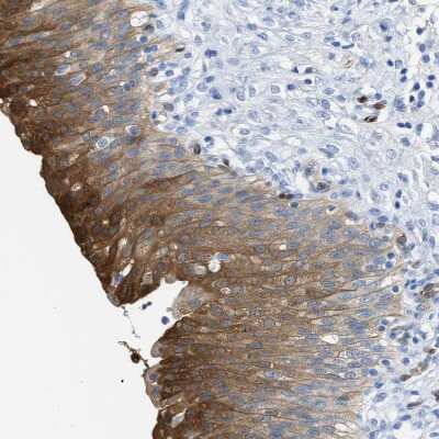 Immunohistochemistry-Paraffin: Argininosuccinate Synthase Antibody [NBP1-88868]