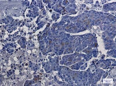Immunohistochemistry-Paraffin: Argininosuccinate Synthase Antibody (S02-7A8) [NBP3-19945]