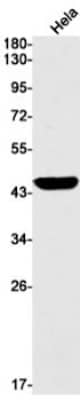 Western Blot: Argininosuccinate Synthase Antibody (S02-7A8) [NBP3-19945]