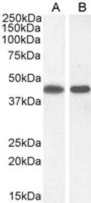 Western Blot: Argininosuccinate Synthase Antibody [NBP1-00153]