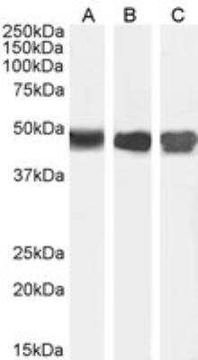 Western Blot: Argininosuccinate Synthase Antibody [NBP1-00153]