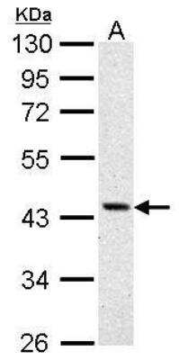 Western Blot: Argininosuccinate Synthase Antibody [NBP1-31522]