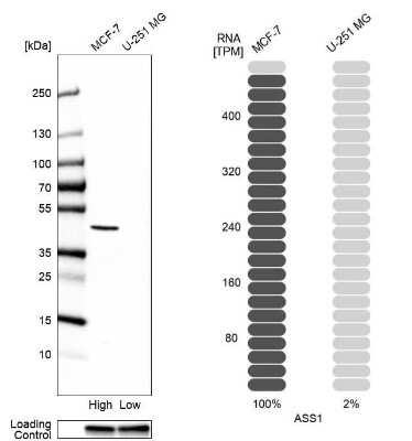 Western Blot: Argininosuccinate Synthase Antibody [NBP1-88867]