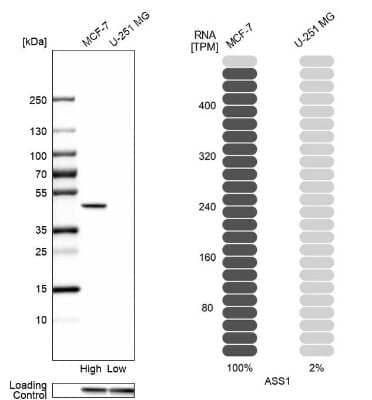 Western Blot: Argininosuccinate Synthase Antibody [NBP1-88868]