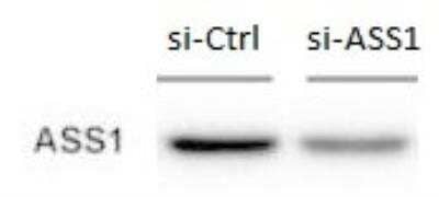 Western Blot: Argininosuccinate Synthase Antibody [NBP1-88868]