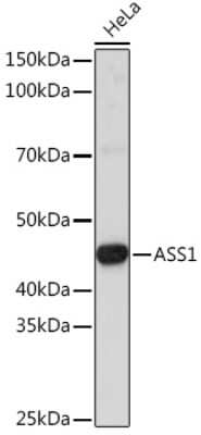 Western Blot: Argininosuccinate Synthase AntibodyAzide and BSA Free [NBP3-15488]