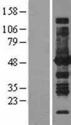 Western Blot: Argininosuccinate Synthase Overexpression Lysate [NBL1-07778]