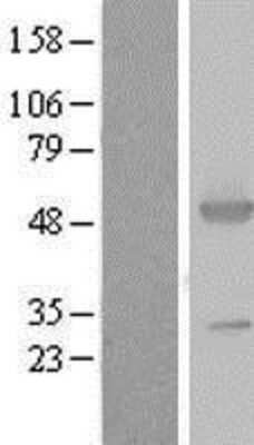 Western Blot: Argininosuccinate Synthase Overexpression Lysate [NBL1-07779]