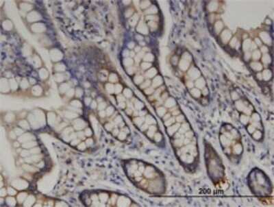 Immunohistochemistry-Paraffin: Arginyl tRNA synthetase Antibody (1A2) [H00005917-M02]