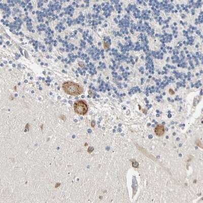 Immunohistochemistry-Paraffin: Arginyl tRNA synthetase Antibody [NBP1-88033]