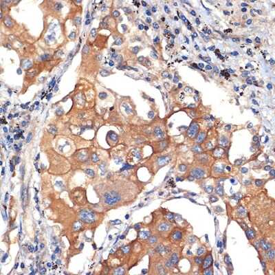 Immunohistochemistry-Paraffin: Argonaute 3 Antibody (8E0O6) [NBP3-15939]