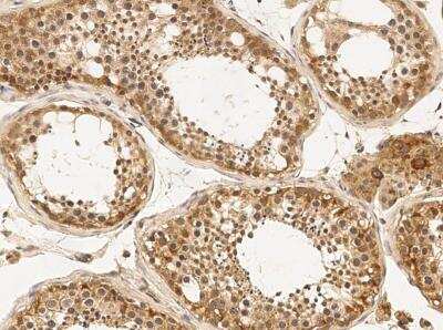 Immunohistochemistry-Paraffin: Argonaute 4 Antibody [NBP3-05866]