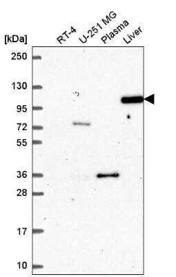 Western Blot: Argonaute 4 Antibody [NBP2-57022]