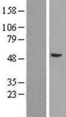 Western Blot: Argonaute 4 Overexpression Lysate [NBP2-04363]