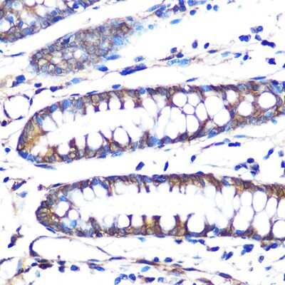Immunohistochemistry-Paraffin: Aromatase Antibody (5C5N7) [NBP3-15438]