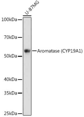 Western Blot: Aromatase Antibody (5C5N7) [NBP3-15438]