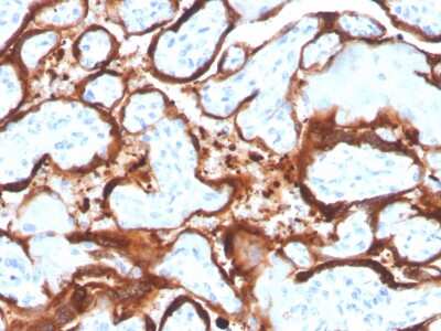 Immunohistochemistry-Paraffin: Aromatase Antibody (CYP19A1/4257) - Azide and BSA Free [NBP3-08711]