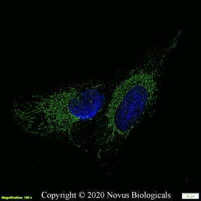 Immunocytochemistry/ Immunofluorescence: Aromatase Antibody [NB100-1596]