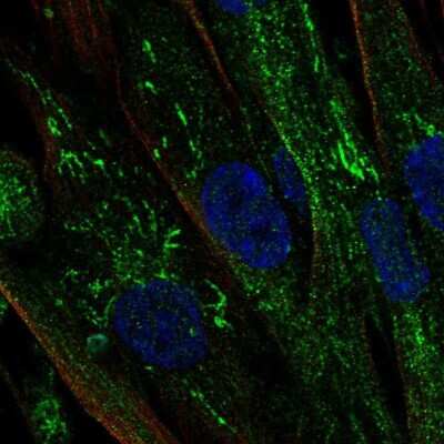 Immunocytochemistry/ Immunofluorescence: Aromatase Antibody [NBP2-48998]